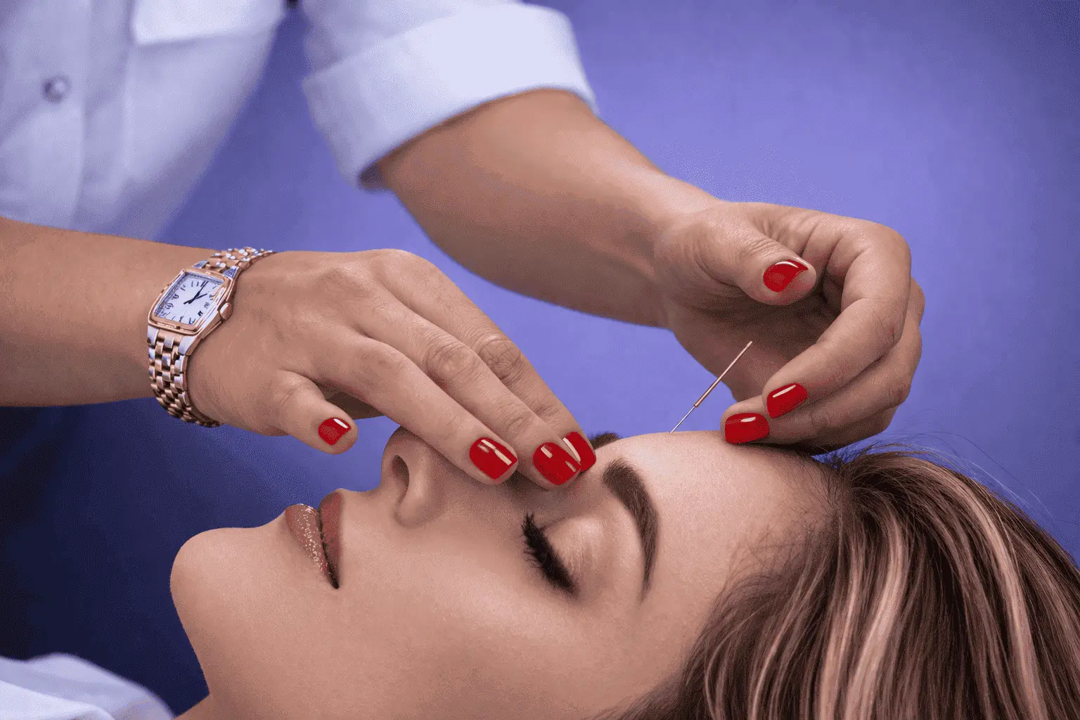 Acupuncture faciale en entreprise : pose d'une aiguille sur le visage