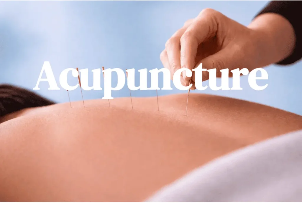 acupuncture
