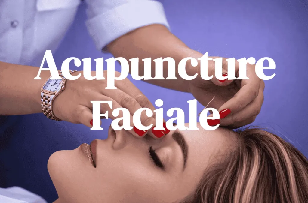acupuncture faciale